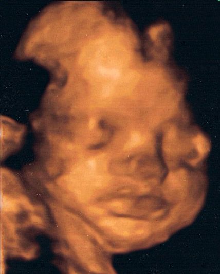 Dominic my unborn child.
